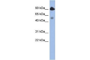 WB Suggested Anti-BCL2L13 Antibody Titration:  0. (BCL2L13 anticorps  (Middle Region))