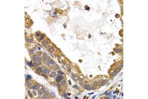 Immunohistochemistry (IHC) image for anti-Glycogen Synthase 1 (Muscle) (GYS1) (AA 488-737) antibody (ABIN3016178)