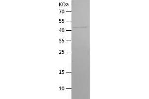 Western Blotting (WB) image for Follicle Stimulating Hormone Receptor (FSHR) (AA 35-240) protein (His-IF2DI Tag) (ABIN7122985)
