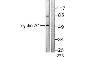 Western blot analysis of extracts from SKOV3 cells, using Cyclin A1 antibody (#C0166). (Cyclin A1 anticorps)
