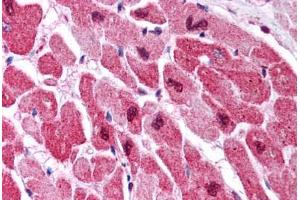Human Heart (formalin-fixed, paraffin-embedded) stained with MAPK1 antibody ABIN305764 at 5 ug/ml followed by biotinylated anti-mouse IgG secondary antibody ABIN481714, alkaline phosphatase-streptavidin and chromogen. (ERK2 anticorps)