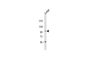 Anti-LARGE Antibody (Center) at 1:2000 dilution + Jurkat whole cell lysate Lysates/proteins at 20 μg per lane. (LARGE anticorps  (AA 365-398))