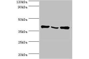 Western blot All lanes: EIF3H antibody at 6 μg/mL Lane 1: NIH/3T3 whole cell lysate Lane 2: Rat brain tissue Lane 3: U251 whole cell lysate Secondary Goat polyclonal to rabbit IgG at 1/10000 dilution Predicted band size: 40 kDa Observed band size: 40 kDa (EIF3H anticorps  (AA 80-340))