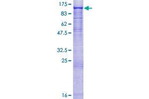 Image no. 1 for Suppression of Tumorigenicity 14 (ST14) (AA 1-855) protein (GST tag) (ABIN1321472)