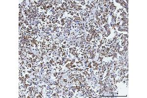 IHC analysis of GLUD1/2 using anti-GLUD1/2 antibody (ABIN7602000). (GLUD1 / GLUD2 (AA 54-553) anticorps)