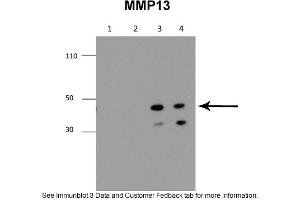 Sample Type: 1. (MMP13 anticorps  (Middle Region))