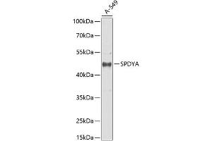 Western blot analysis of extracts of  cells, using SPDYA antibody (ABIN6132705, ABIN6148336, ABIN6148337 and ABIN6217670) at 1:1000 dilution. (SPDYA anticorps  (AA 1-313))