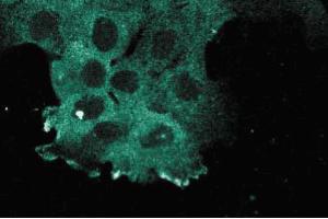 Immunofluorescence staining of A431 cells. (KIF11 anticorps  (AA 324-532))