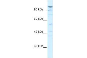 WB Suggested Anti-LAntibody Titration:  5. (LARP1B anticorps  (Middle Region))