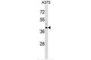 Western blot analysis in A375 cell line lysates (35ug/lane) using Snurportin-1 (SNUPN) Antibody . (Snurportin 1 anticorps  (Middle Region))