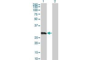 Western Blot analysis of VCX3A expression in transfected 293T cell line by VCX3A monoclonal antibody (M01), clone 6A3. (VCX3A anticorps  (AA 2-100))