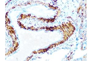Immunohistochemistry of paraffin-embedded rat ovary using AMPKβ1 Rabbit mAb (ABIN7269654) at dilution of 1:100 (40x lens).