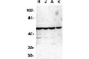 Western Blotting (WB) image for anti-Caspase 10, Apoptosis-Related Cysteine Peptidase (CASP10) (C-Term) antibody (ABIN1030316) (Caspase 10 anticorps  (C-Term))