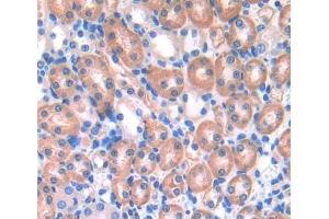 Used in DAB staining on fromalin fixed paraffin- embedded kidney tissue (ENOX2 anticorps  (AA 1-207))