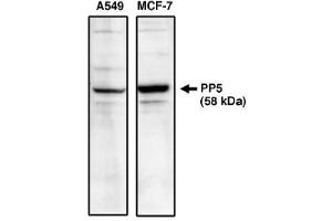Image no. 1 for anti-Protein Phosphatase 5, Catalytic Subunit (PPP5C) antibody (ABIN265046) (PP5 anticorps)