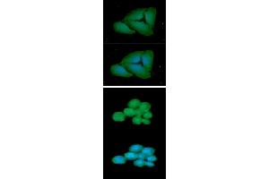 ICC/IF analysis of FCGR1A in HeLa cells line, stained with DAPI (Blue) for nucleus staining and monoclonal anti-human FCGR1A antibody (1:100) with goat anti-mouse IgG-Alexa fluor 488 conjugate (Green).