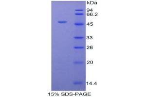 SDS-PAGE analysis of Cow Orosomucoid 1 Protein. (ORM1 Protéine)