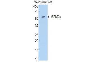 Western Blotting (WB) image for anti-Amyloid P Component, Serum (APCS) (AA 23-223) antibody (ABIN1860495) (APCS anticorps  (AA 23-223))