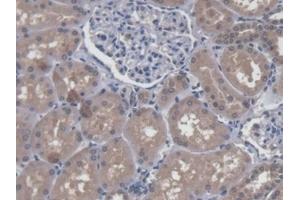 DAB staining on IHC-P; Samples: Human Kidney Tissue (LUC7-Like 3 anticorps  (AA 1-247))