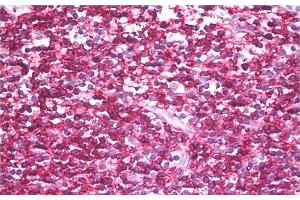 Immunohistochemistry staining of human tonsil (paraffin sections) using anti-CD45RB (clone MEM-143). (CD45RB anticorps)