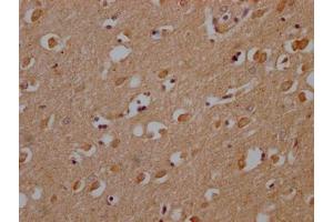 IHC image of ABIN7139953 diluted at 1:200 and staining in paraffin-embedded human brain tissue performed on a Leica BondTM system. (OR1A2 anticorps  (AA 247-262))