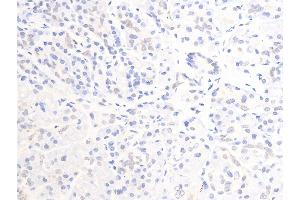 ABIN6267284 at 1/100 staining human pancreatic tissue sections by IHC-P.