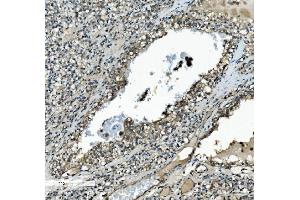 IHC analysis of MEK2/MAP2K2 using anti-MEK2/MAP2K2 antibody (ABIN7599356).