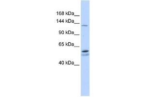 WB Suggested Anti-PUM2 Antibody Titration:  0.