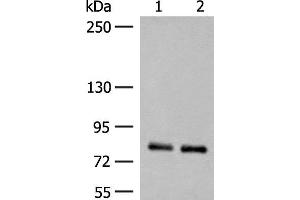 Western blot analysis of Rat brain tissue and Mouse brain tissue lysates using NGEF Polyclonal Antibody at dilution of 1:250 (NGEF anticorps)