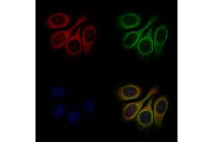 ABIN7093174 and ABIN7101256 staining Hela cells by IF/ICC. (C9 anticorps)