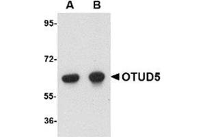 Western blot analysis of OTUD5 in human kidney lysate with OTUD5 antibody at (A) 1 and (B) 2 μg/ml. (OTUD5 anticorps  (C-Term))