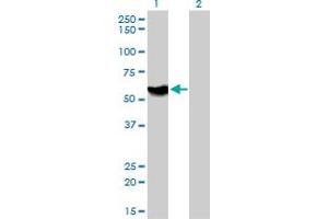 Western Blot analysis of ATP6AP1 expression in transfected 293T cell line by ATP6AP1 monoclonal antibody (M01), clone 3A2. (ATP6AP1 anticorps  (AA 51-150))
