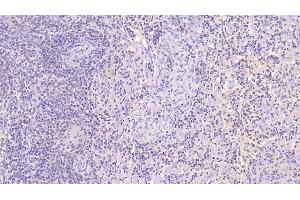 Detection of NRGN in Human Spleen Tissue using Monoclonal Antibody to Neurogranin (NRGN) (Neurogranin anticorps  (AA 1-67))