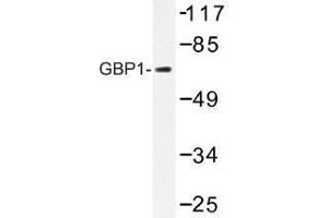 Image no. 1 for anti-GTP Binding Protein 1 (GTPBP1) antibody (ABIN317811) (GTPBP1 anticorps)