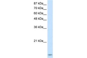 Western Blotting (WB) image for anti-TAR (HIV-1) RNA Binding Protein 2 (TARBP2) antibody (ABIN2462162) (TARBP2 anticorps)