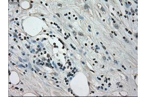 Image no. 4 for anti-Crystallin, alpha B (CRYAB) antibody (ABIN1497645) (CRYAB anticorps)