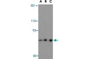 Western blot analysis of NCSTN in mouse brain tissue lysate with NCSTN polyclonal antibody  at (A) 0.