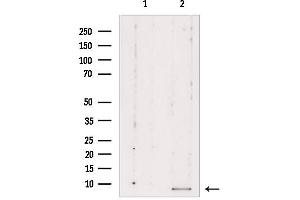 Western blot analysis of extracts from Mouse cancer, using RPL39 Antibody. (RPL39 anticorps  (C-Term))