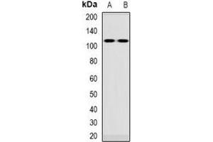 Western blot analysis of VPS54 expression in Jurkat (A), rat blood (B) whole cell lysates. (VPS54 anticorps)