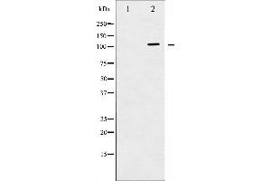 Western blot analysis of c-PLA2 expression in TNF-a treated HeLa whole cell lysates,The lane on the left is treated with the antigen-specific peptide. (PLA2G4A anticorps  (Internal Region))