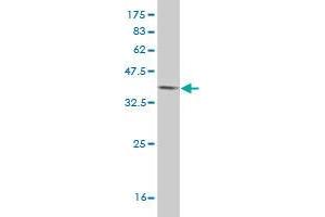 Western Blot detection against Immunogen (37.