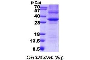 Image no. 1 for Prohibitin (PHB) (AA 1-272) protein (His tag) (ABIN1098557)