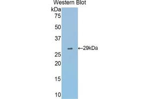 Western blot analysis of the recombinant protein. (Fascin anticorps  (AA 27-273))