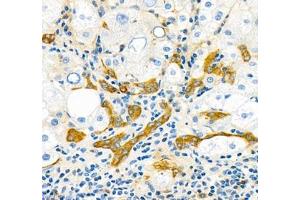Immunohistochemistry of paraffin embedded human liver using THNSL2 (ABIN7075893) at dilution of 1: 400 (400x lens)