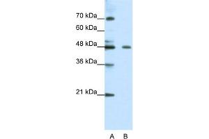 WB Suggested Anti-ZNF645 Antibody Titration:  0. (ZNF645 anticorps  (N-Term))
