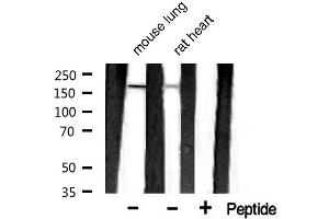 Western blot analysis of extracts of various celllines,using MAP2 antibody.