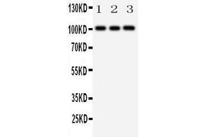 Anti-MCK10 antibody, Western blotting Lane 1: A431 Cell Lysate Lane 2: A549 Cell Lysate Lane 3: HELA Cell Lysate (DDR1 anticorps  (C-Term))