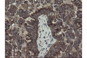 Image no. 9 for anti-Acyl-CoA Binding Domain Containing 3 (Acbd3) antibody (ABIN1498415)