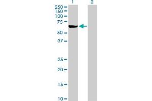 Western Blot analysis of ME1 expression in transfected 293T cell line by ME1 MaxPab polyclonal antibody. (ME1 anticorps  (AA 1-572))