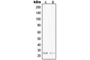 Western blot analysis of PPP1R14D expression in Jurkat (A), HepG2 (B) whole cell lysates. (PPP1R14D anticorps  (Center))